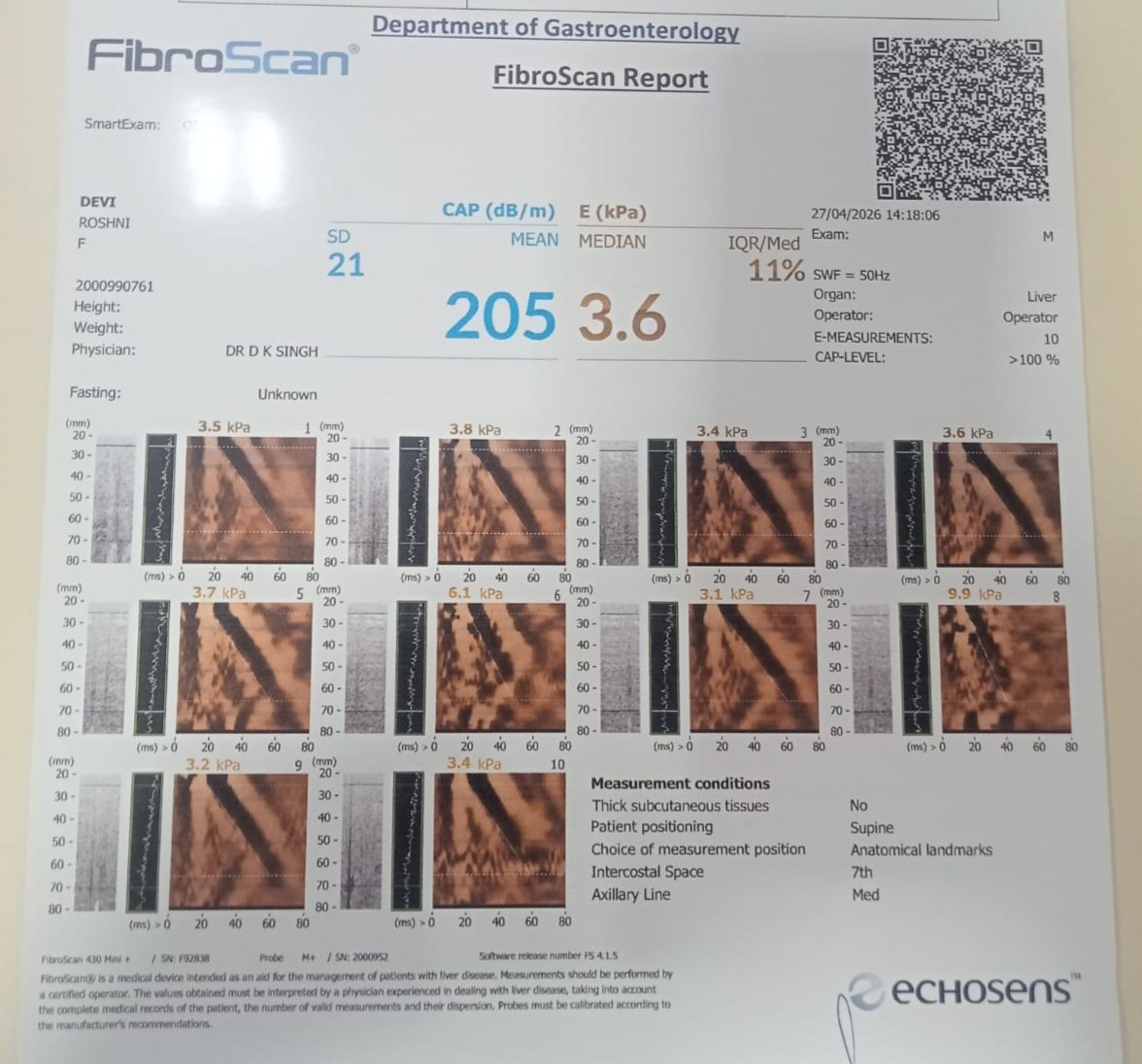 Liver FibroScan with CAP